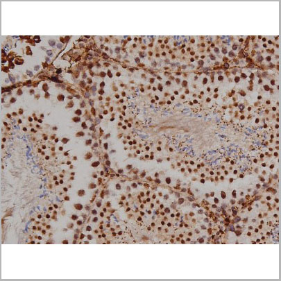 product-image-AAA31003_IHC7.jpg