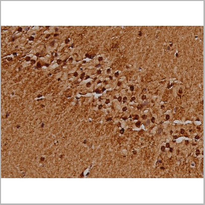 product-image-AAA31003_IHC8.jpg