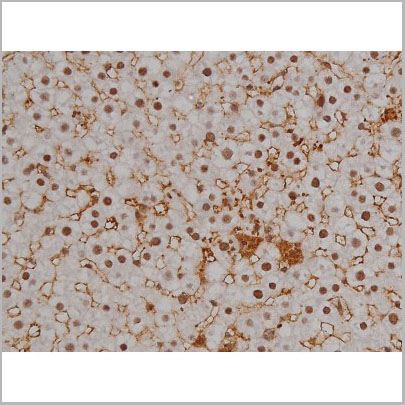 product-image-AAA31003_IHC9.jpg