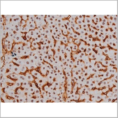 product-image-AAA31004_IHC10.jpg