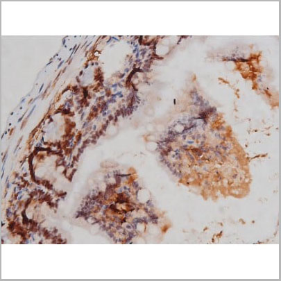 product-image-AAA31004_IHC11.jpg