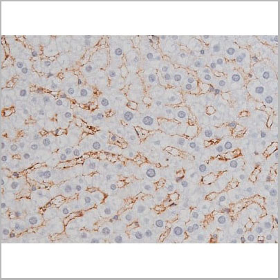 product-image-AAA31004_IHC13.jpg