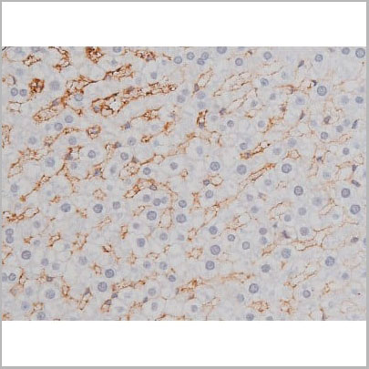 product-image-AAA31004_IHC14.jpg