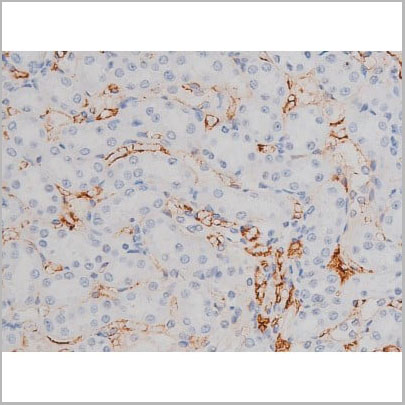 product-image-AAA31004_IHC15.jpg