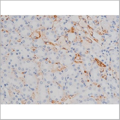 product-image-AAA31004_IHC16.jpg