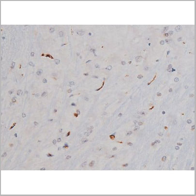 product-image-AAA31004_IHC17.jpg