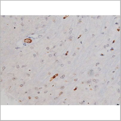 product-image-AAA31004_IHC18.jpg