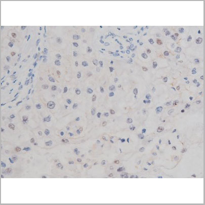product-image-AAA31004_IHC3.jpg