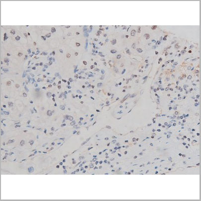 product-image-AAA31004_IHC4.jpg