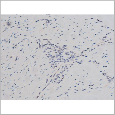 product-image-AAA31004_IHC6.jpg