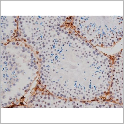 product-image-AAA31004_IHC7.jpg