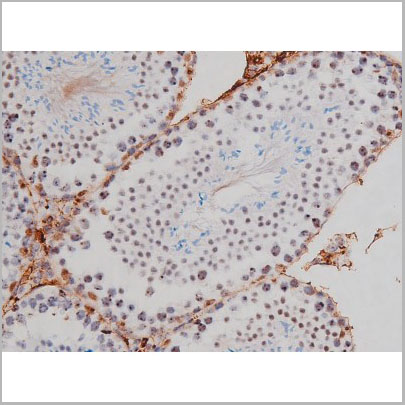 product-image-AAA31004_IHC8.jpg