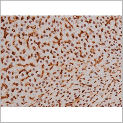 product-image-AAA31004_IHC9.jpg