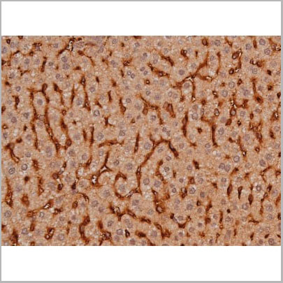 product-image-AAA31005_IHC11.jpg