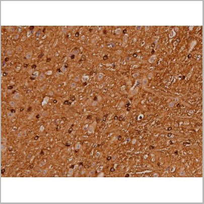product-image-AAA31005_IHC12.jpg