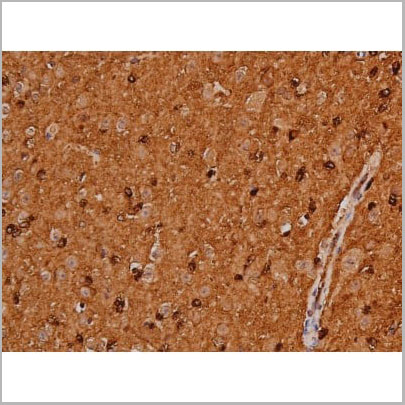 product-image-AAA31005_IHC13.jpg