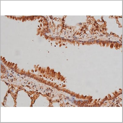 product-image-AAA31005_IHC14.jpg