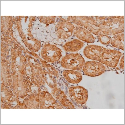 product-image-AAA31005_IHC16.jpg