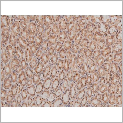 product-image-AAA31005_IHC17.jpg