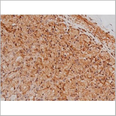 product-image-AAA31005_IHC18.jpg