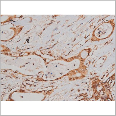 product-image-AAA31005_IHC2.jpg