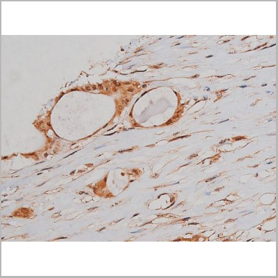 product-image-AAA31005_IHC3.jpg