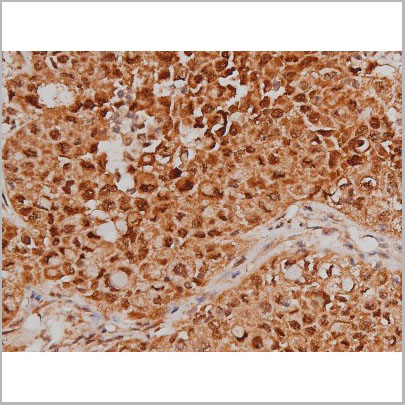 product-image-AAA31005_IHC4.jpg