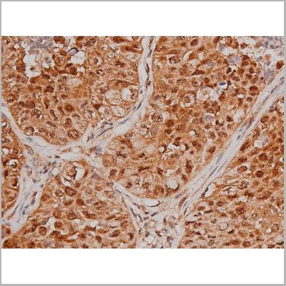 product-image-AAA31005_IHC5.jpg