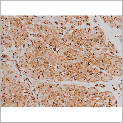 product-image-AAA31005_IHC6.jpg
