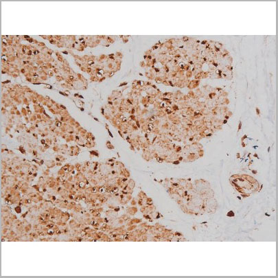 product-image-AAA31005_IHC7.jpg