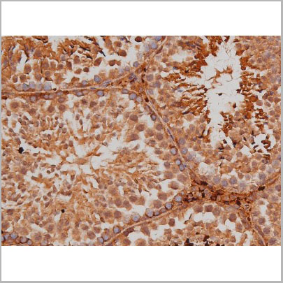 product-image-AAA31005_IHC8.jpg