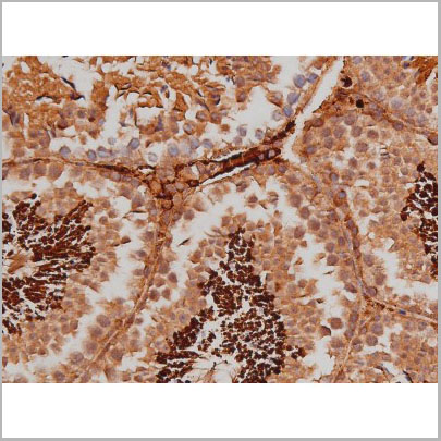 product-image-AAA31005_IHC9.jpg
