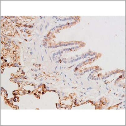 product-image-AAA31006_IHC11.jpg