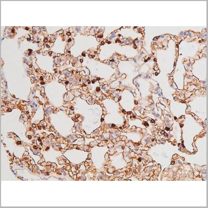product-image-AAA31006_IHC12.jpg