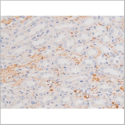 product-image-AAA31006_IHC13.jpg