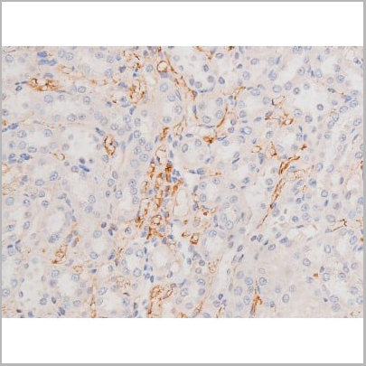 product-image-AAA31006_IHC14.jpg