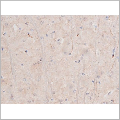 product-image-AAA31006_IHC15.jpg