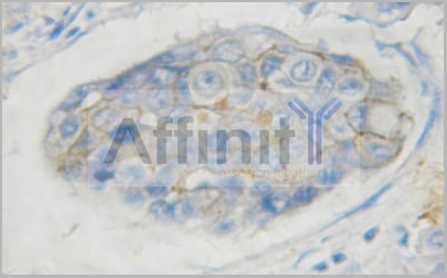 product-image-AAA31006_IHC16.jpg