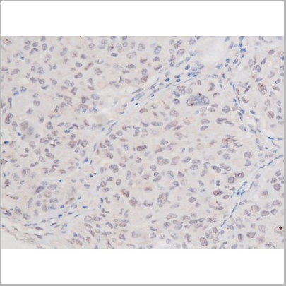 product-image-AAA31006_IHC3.jpg