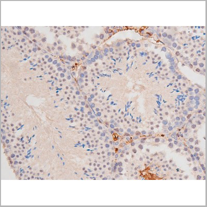 product-image-AAA31006_IHC5.jpg
