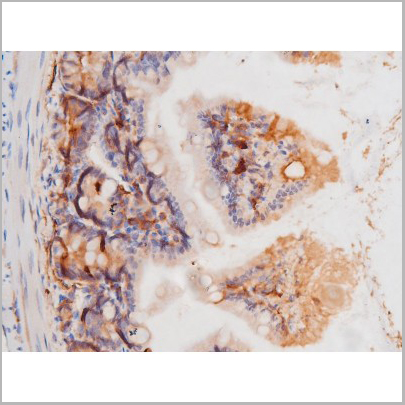 product-image-AAA31006_IHC9.jpg