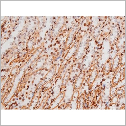 product-image-AAA31007_IHC10.jpg