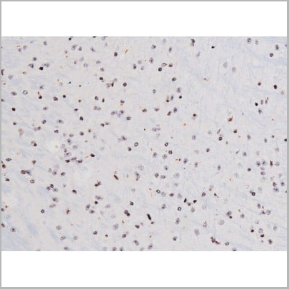 product-image-AAA31007_IHC11.jpg