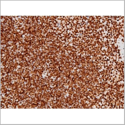 product-image-AAA31007_IHC13.jpg