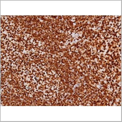 product-image-AAA31007_IHC14.jpg