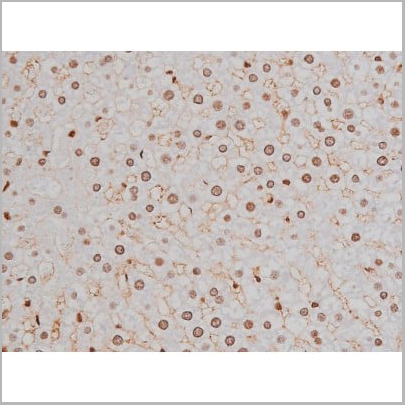 product-image-AAA31007_IHC15.jpg