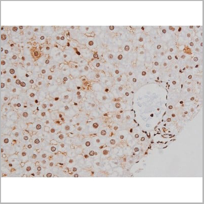 product-image-AAA31007_IHC16.jpg