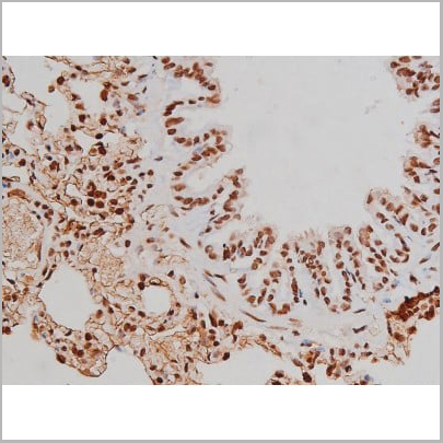 product-image-AAA31007_IHC17.jpg