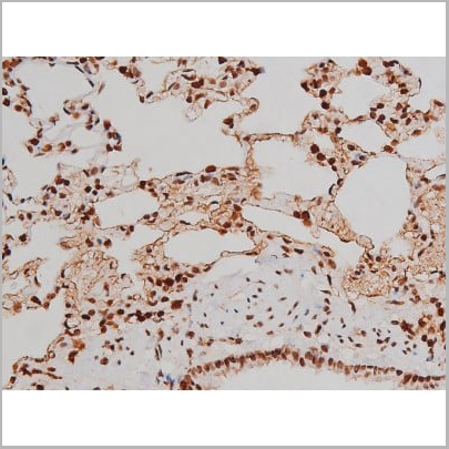product-image-AAA31007_IHC18.jpg