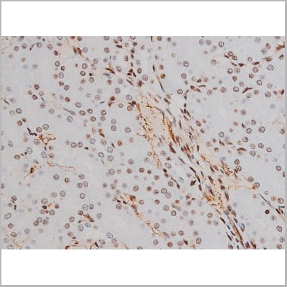 product-image-AAA31007_IHC19.jpg